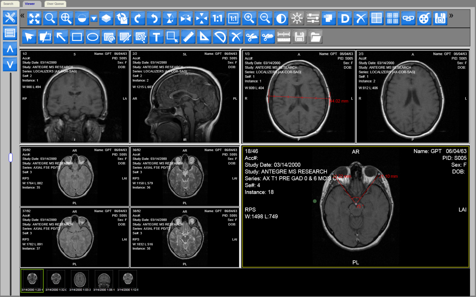 DICOM online viewer